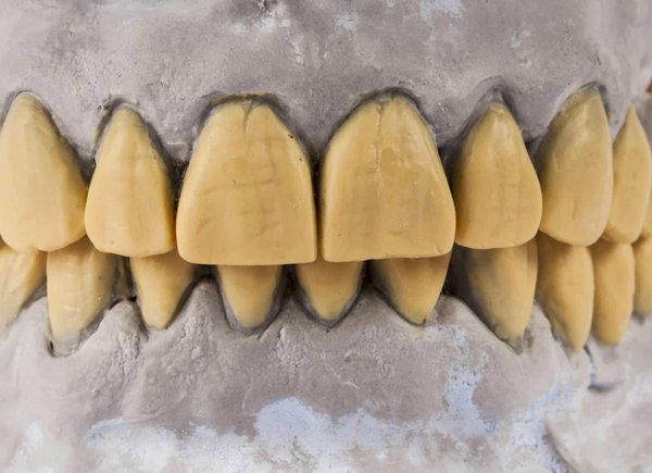 Quels sont les derniers développements en bio-impression pour la régénération tissulaire ?